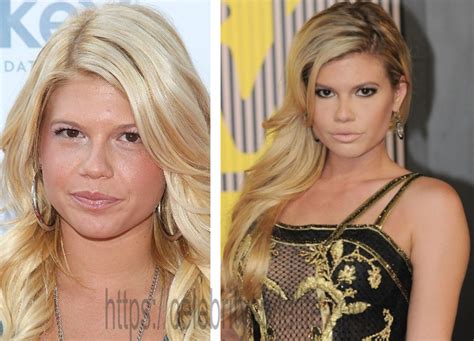 chanel west coast before plastic surgery|is chanel west coast transformation.